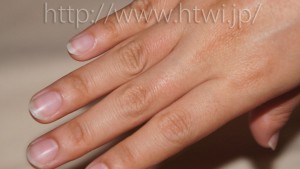 ケノンで手の指脱毛の効果を検証