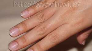 ケノンで手の指脱毛の効果を検証